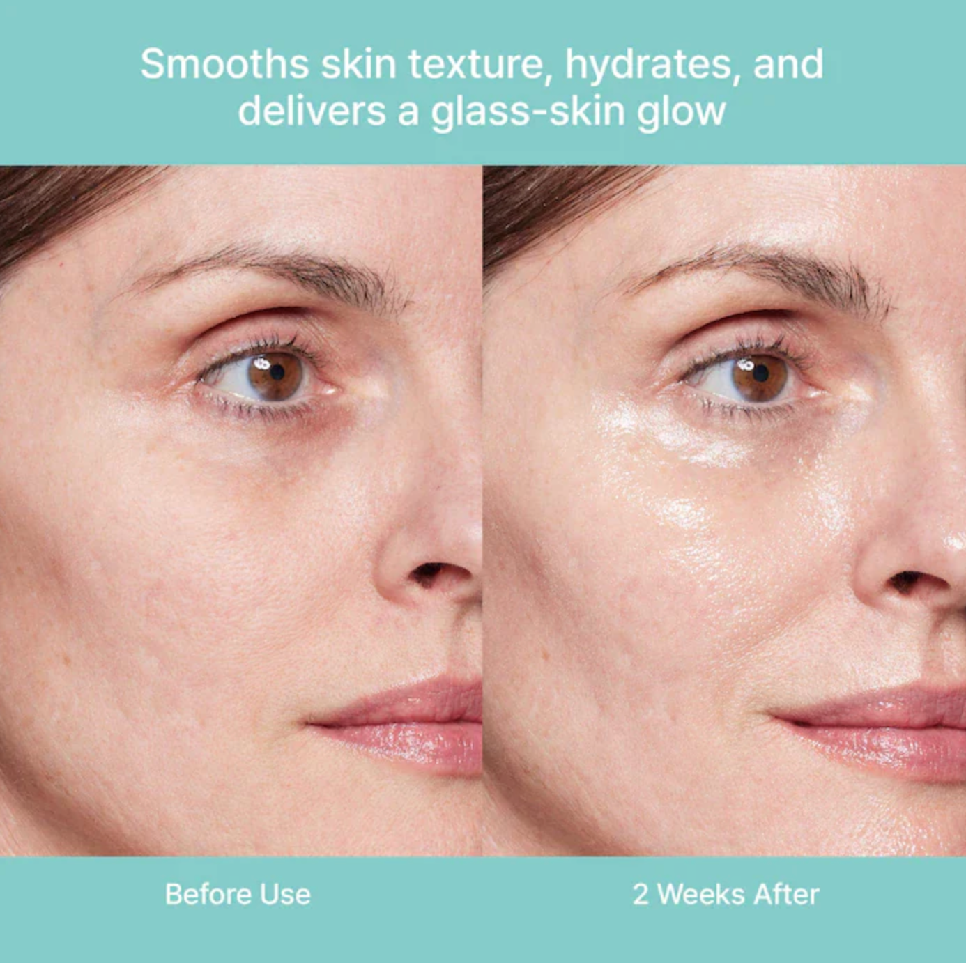 Healer Turnover Ampoule by Rejuran